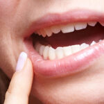 جلوگیری از عفونت دندان عقل