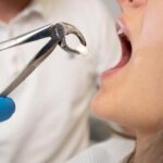 دندان عقل چه زمانی نیاز به جراحی دارد؟