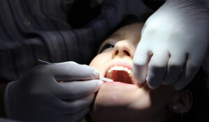 کشیدن دندان عقل چقدر دردناک است؟