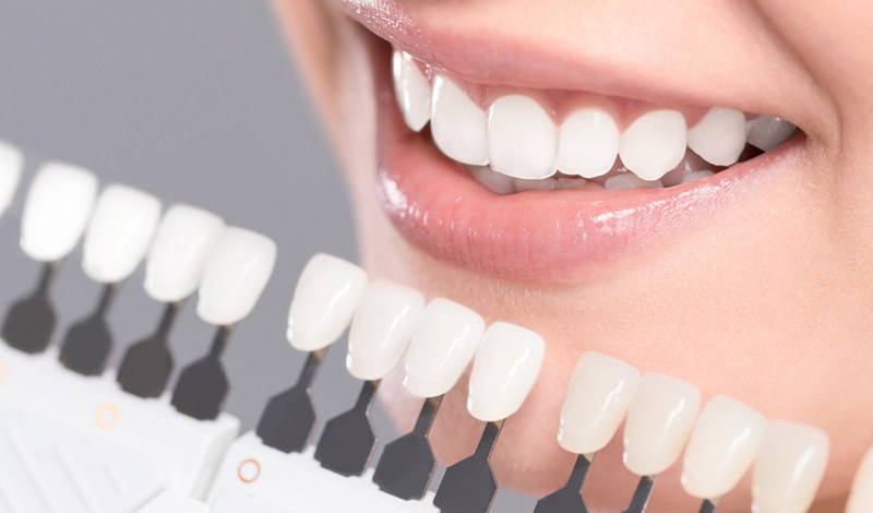 علت درد دندان بعد از روکش دندان
