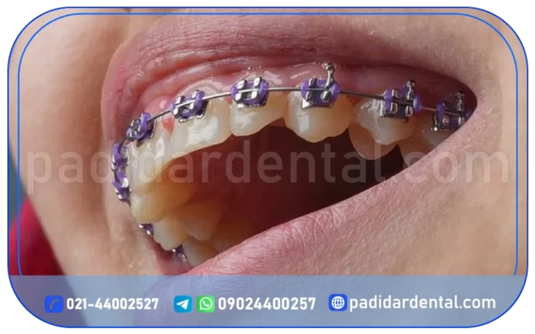 ارتودنسی دندان در جنت آباد شمالی