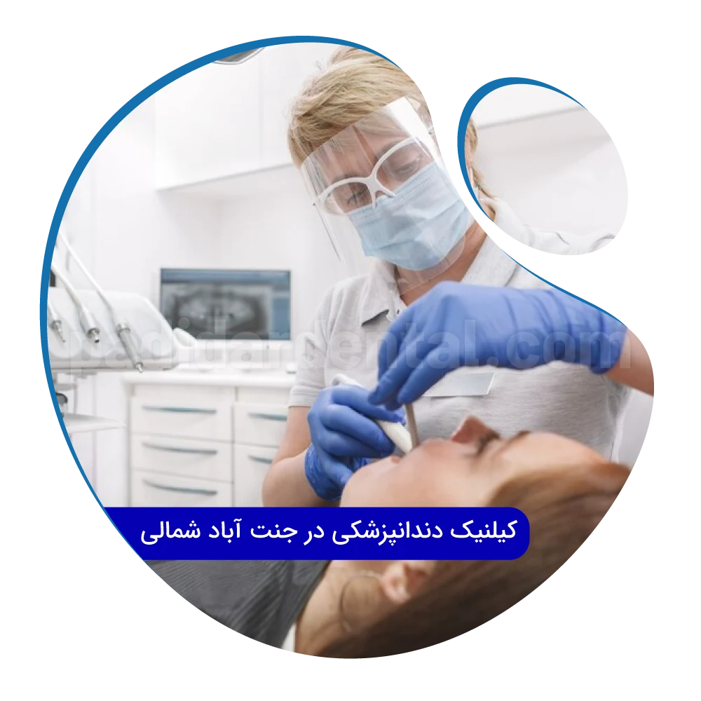 لمینت دندان در جنت آباد شمالی