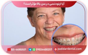 آیا ارتودنسی در سن بالا مؤثر است؟ همه چیز درباره ارتودنسی در بزرگسالان