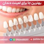 بهترین جا برای لمینت دندان