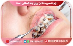 ارتودنسی دندان برای چه کسانی است؟