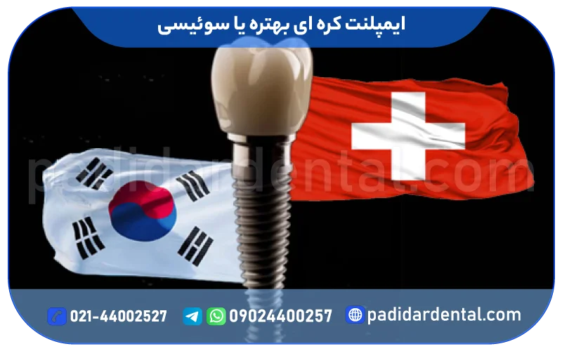 ایمپلنت کره ای بهتره یا سوئیسی