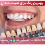 بهترین رنگ برای لمینت دندان