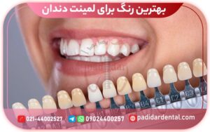 بهترین رنگ برای لمینت دندان