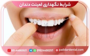 شرایط نگهداری لمینت دندان