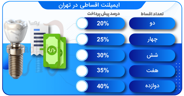 ایمپلنت اقساطی در تهران