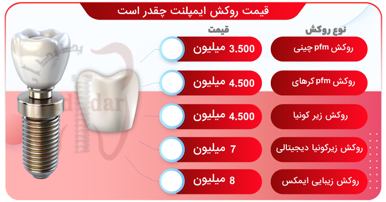 قیمت روکش ایمپلنت دندان