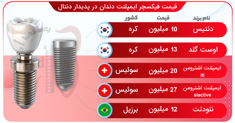 قیمت ایمپلنت دندان در تهران