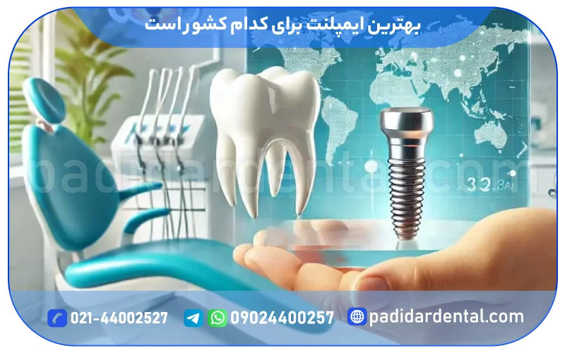 بهترین ایمپلنت برای کدام کشور است؟