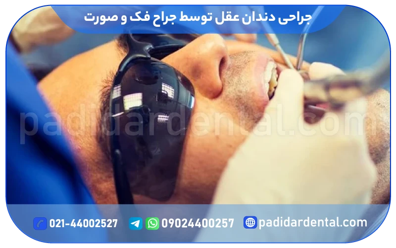 جراحی دندان عقل توسط جراح فک و صورت