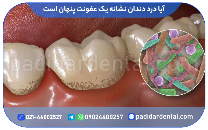 آیا درد دندان نشانه یک عفونت پنهان است