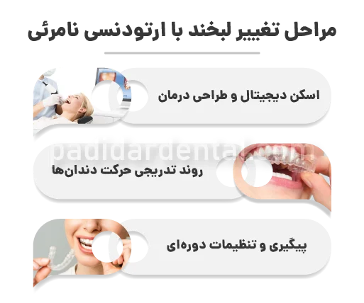 مراحل تغییر لبخند با ارتودنسی نامرئی