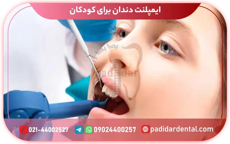 ایمپلنت دندان برای کودکان
