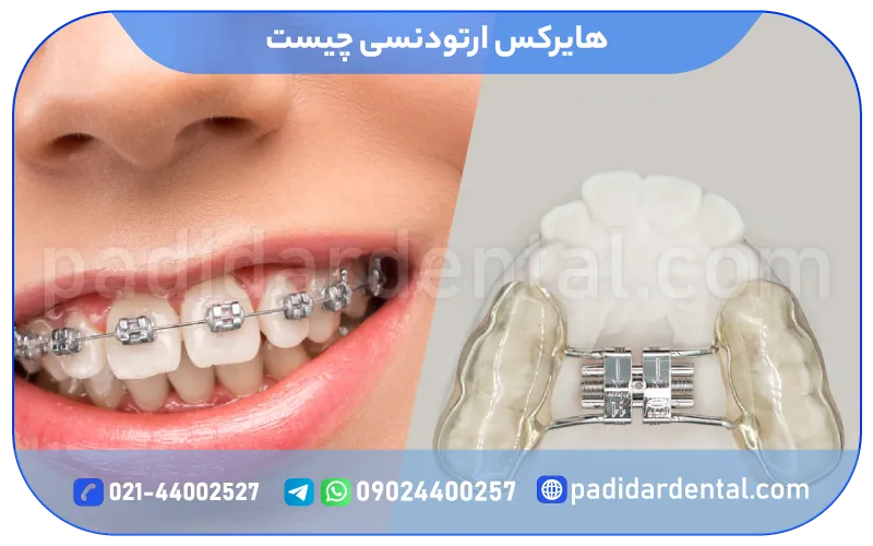 هایرکس ارتودنسی