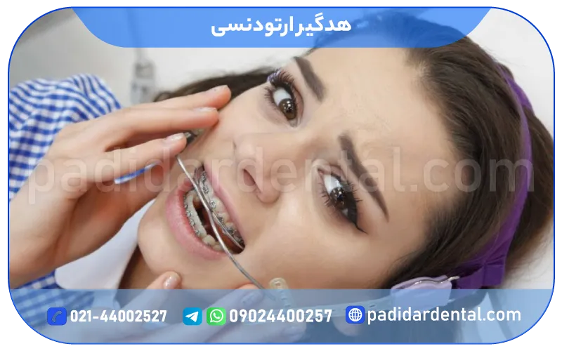 هدگیر ارتودنسی