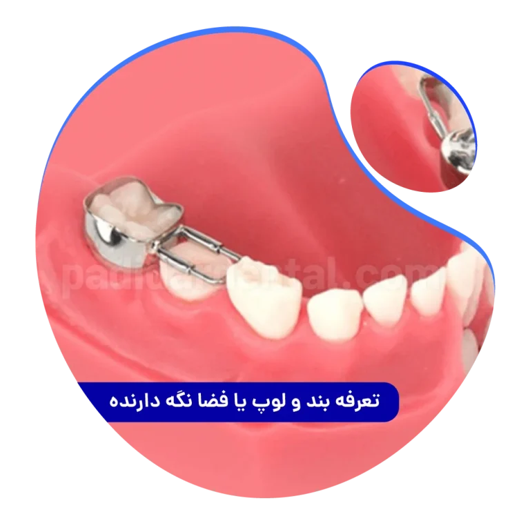 هزینه بند و لوپ یا فضا نگه دارنده