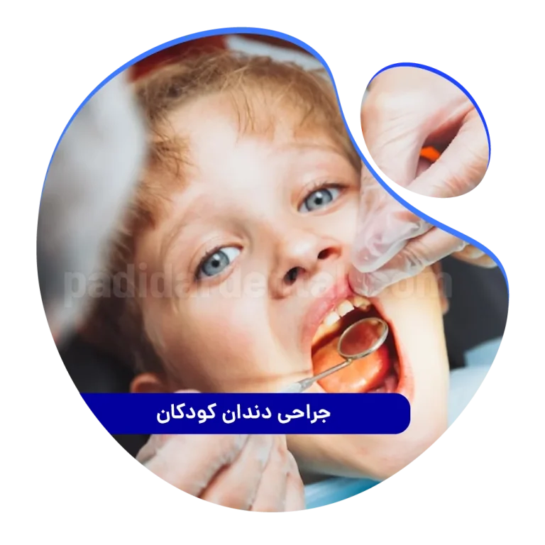 جراحی دندان کودکان