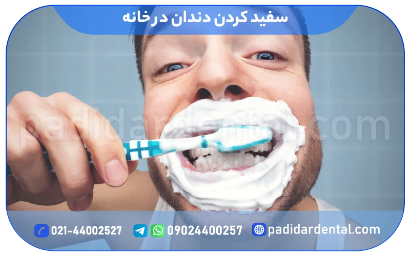 سفید کردن دندان در خانه