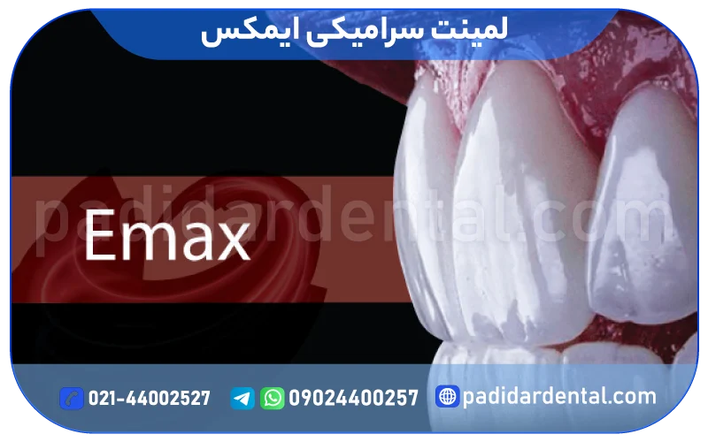 لمینت سرامیکی ایمکس