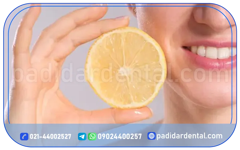 نکات ایمنی برای سفید کردن دندان در خانه