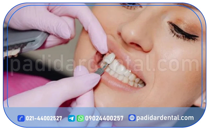 تفاوت لمینت لبه شیشه ای با لمینت معمولی