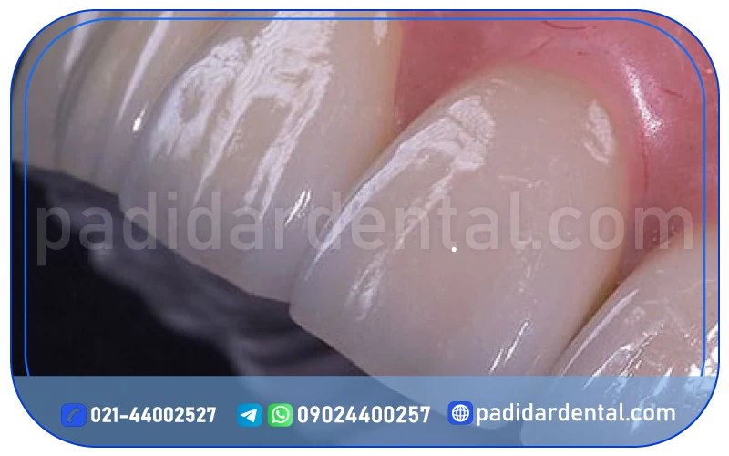 مزایای لمینت لبه شیشه ای